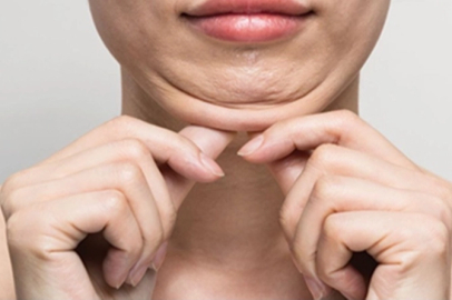 Keşanlı 3 dermatolog, Tiflis’teki Dermavizyon toplantısında buluştu